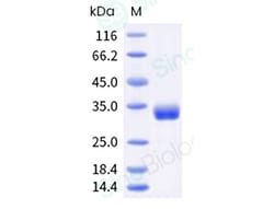 Sino Biological Mouse ANGPT2 Protein 500ug (Sino Biological), Quantity: