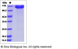 Sino Biological Cynomolgus ALCAM Protein 100ug (Sino Biological), Quantity:
