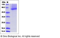 Sino Biological Mouse MMP8 Protein 100ug (Sino Biological), Quantity: Each