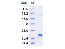 Sino Biological Human CLDN6 Protein 100ug (Sino Biological), Quantity: