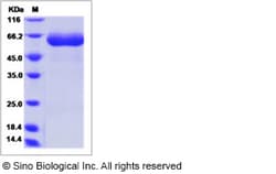 Sino Biological Recombinant Rat IL22RA1 Protein (ECD, hFc Tag), Quantity: