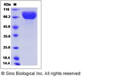 Sino Biological Rat CD274 Protein 100ug (Sino Biological), Quantity: Each