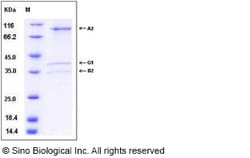 Sino Biological PRKAG1/PRKAB1/PRKAA1 Protein 50ug (Sino Biological), Quantity: