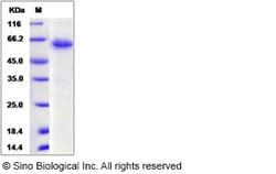Sino Biological Rat JAM2 Protein 100ug (Sino Biological), Quantity: Each