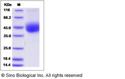 Sino Biological Cynomolgus ART4 Protein 100ug (Sino Biological), Quantity: