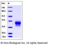 Sino Biological Cynomolgus FCGR2A Protein 100ug (Sino Biological), Quantity:
