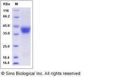 Sino Biological Rat BST1 Protein 100ug (Sino Biological), Quantity: Each