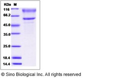 Sino Biological Rat CDH13 Protein 100ug (Sino Biological), Quantity: Each