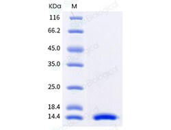 Sino Biological Human IL2 Protein 500ug (Sino Biological), Quantity: Each