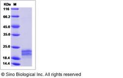 Sino Biological Rat IL17F Protein 50ug (Sino Biological), Quantity: Each