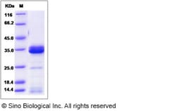 Sino Biological Recombinant Cynomolgus IGFBP4 Protein (His Tag), Quantity: