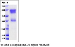 Sino Biological Cynomolgus EDAR Protein 100ug (Sino Biological), Quantity: