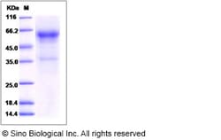 Sino Biological Rhesus CD27 Protein 1MG (Sino Biological), Quantity: Each