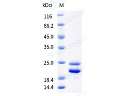 Sino Biological Fra a 1 Protein 250ug (Sino Biological), Quantity: Each