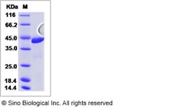 Sino Biological Rat ACAT2 Protein 100ug (Sino Biological), Quantity: Each
