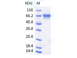 Sino Biological Recombinant Human Vitronectin Protein (His Tag), Quantity: