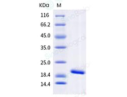 Sino Biological Recombinant Human IL-1 beta Protein, HPLC-verified, Quantity: