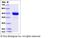 Sino Biological Cynomolgus CD53 Protein 100ug (Sino Biological), Quantity: