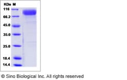 Sino Biological Human IL1RL2 Protein 1MG (Sino Biological), Quantity: Each