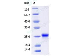 Sino Biological cockroaches Bla g 4 Protein 250ug (Sino Biological), Quantity:
