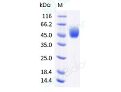 Sino Biological Human IL4R & IL2RG Protein 100ug (Sino Biological), Quantity: