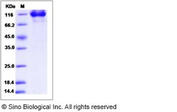 Sino Biological Cynomolgus DPP4 Protein 50ug (Sino Biological), Quantity:
