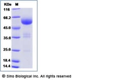 Sino Biological Rat F2 Protein 50ug (Sino Biological), Quantity: Each of