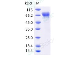 Sino Biological Human PDCD1LG2 Protein 20ug (Sino Biological), Quantity: