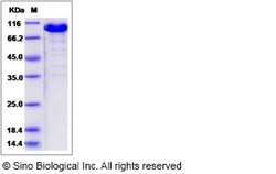 Sino Biological Cynomolgus EphB6 Protein 200ug (Sino Biological), Quantity: