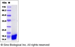 Sino Biological Rat LGALS1 Protein 100ug (Sino Biological), Quantity: Each