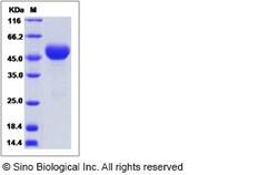 Sino Biological Mouse SERPINA1D Protein 50ug (Sino Biological), Quantity:
