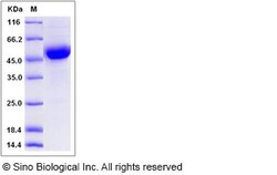 Sino Biological Rat CD79B Protein 100ug (Sino Biological), Quantity: Each