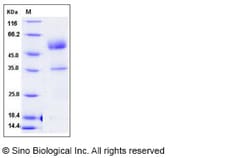 Sino Biological Mouse PGF Protein 500ug (Sino Biological), Quantity: Each