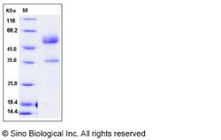Sino Biological Mouse PGF Protein 50ug (Sino Biological), Quantity: Each