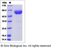 Sino Biological Rat PDPN Protein 200ug (Sino Biological), Quantity: Each
