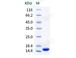 Sino Biological Recombinant Human, Mouse, Rat, Cynomolgus, Rhesus, Rabbit
