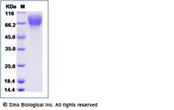 Sino Biological Rhesus CSF1R Protein 100ug (Sino Biological), Quantity: