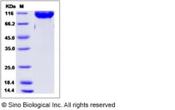 Sino Biological Rat CSF1R Protein 100ug (Sino Biological), Quantity: Each
