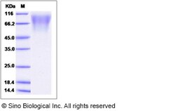 Sino Biological Rhesus LAMP3 Protein 100ug (Sino Biological), Quantity: