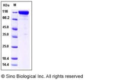 Sino Biological Human MME Protein 50ug (Sino Biological), Quantity: Each