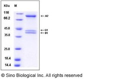 Sino Biological PRKAG1/PRKAB1/PRKAA1 Protein 50ug (Sino Biological), Quantity: