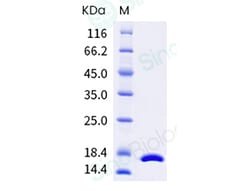 Sino Biological Recombinant Human TNF-alpha Protein, GMP grade, HPLC-verified,