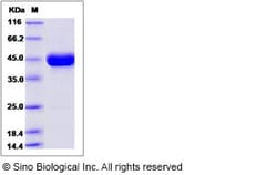 Sino Biological Cynomolgus REG1A Protein 100ug (Sino Biological), Quantity: