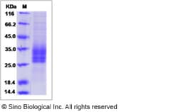 Sino Biological Rat NCR3 Protein 100ug (Sino Biological), Quantity: Each