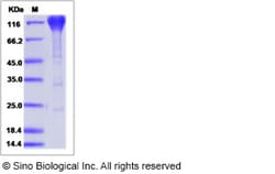 Sino Biological Rhesus PDGFRB Protein 100ug (Sino Biological), Quantity: