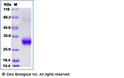 Sino Biological Rat PTGDS Protein 100ug (Sino Biological), Quantity: Each