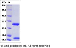 Sino Biological Rat PLAU Protein 50ug (Sino Biological), Quantity: Each