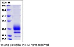 Sino Biological Rhesus CD160 Protein 100ug (Sino Biological), Quantity:
