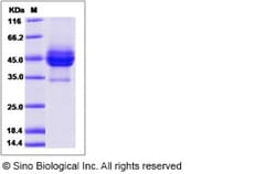 Sino Biological Rat CD63 Protein 100ug (Sino Biological), Quantity: Each