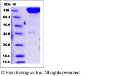 Sino Biological Rat PDGFRA Protein 100ug (Sino Biological), Quantity: Each